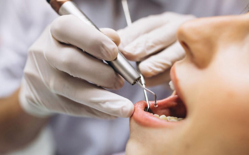 maple ridge dentists