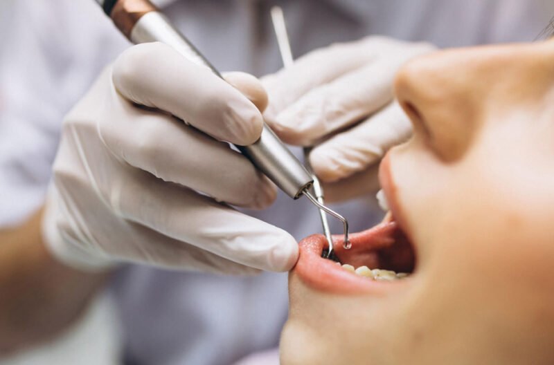 maple ridge dentists