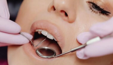 dental benefits decoded