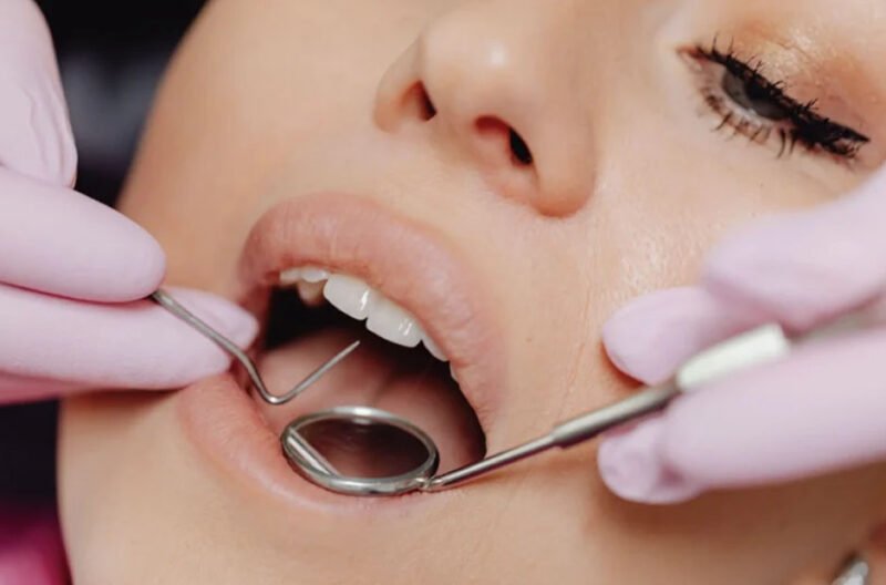 dental benefits decoded