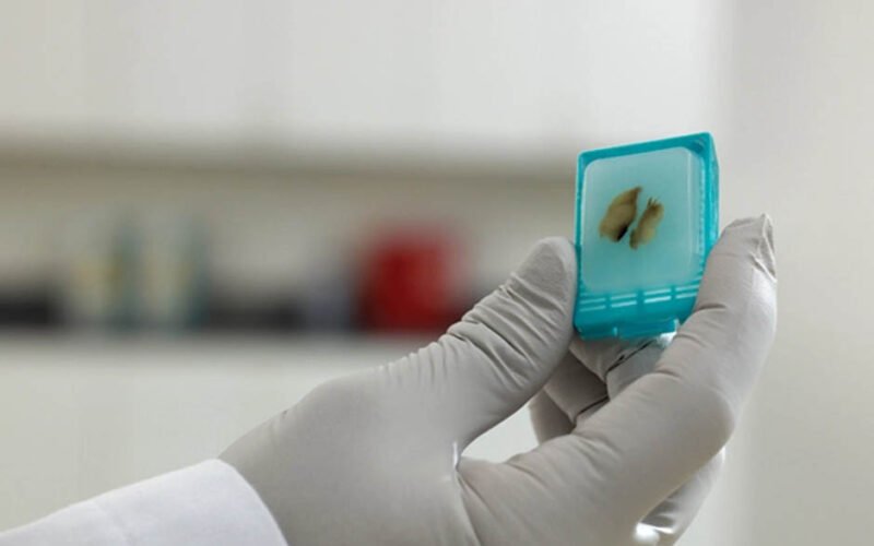ffpe tissue preservation