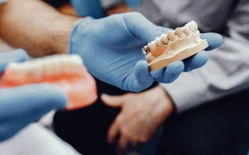 aesthetic aspects of dental implants