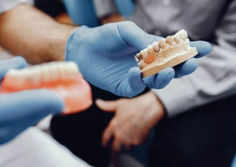 aesthetic aspects of dental implants