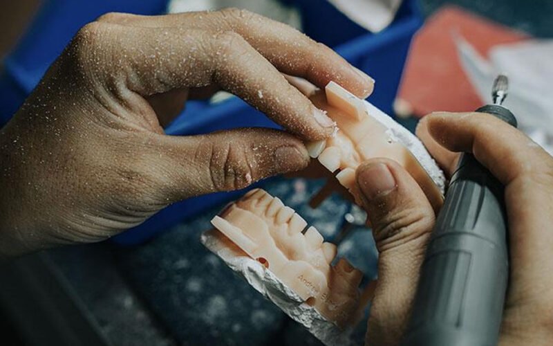 the art of dental technology