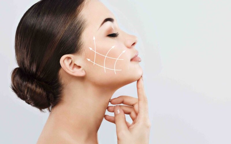 face lift