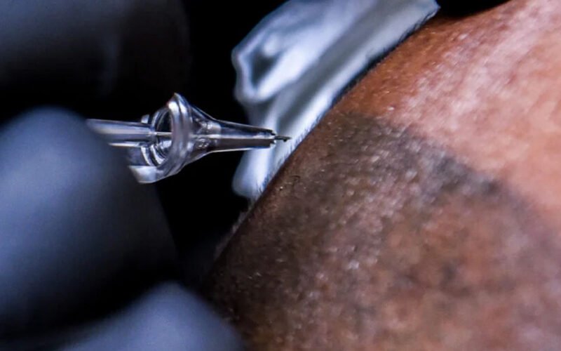 how does scalp micropigmentation work