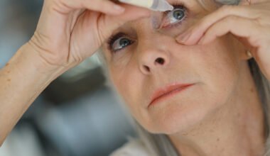 how long does it take to recover from cataract surgery