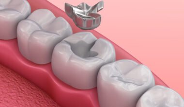 lose a dental filling or crown
