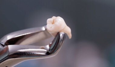 myths about teeth extraction