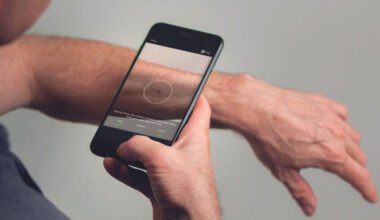 should you trust an ai skin cancer detection app