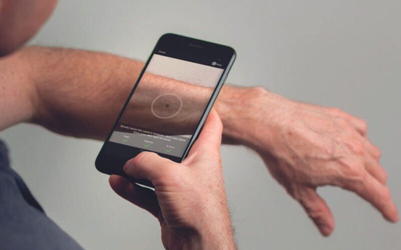 should you trust an ai skin cancer detection app