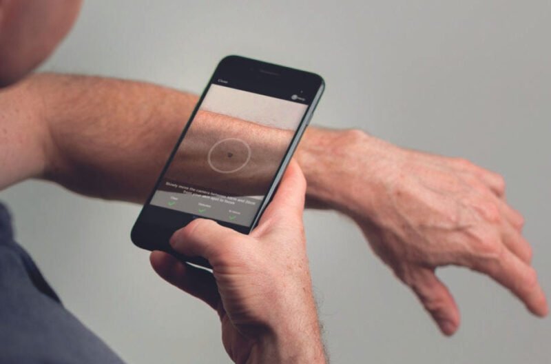 should you trust an ai skin cancer detection app