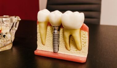 preparing for dental implant surgery