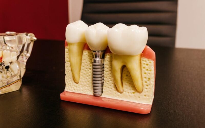 preparing for dental implant surgery