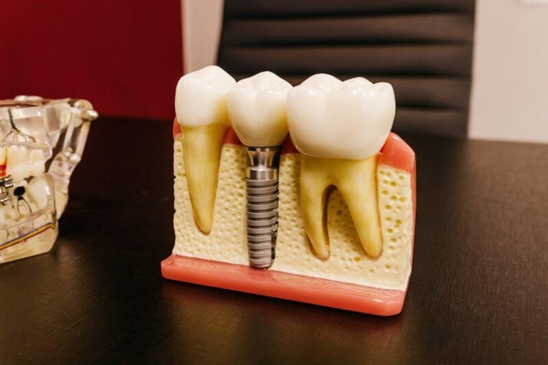 preparing for dental implant surgery