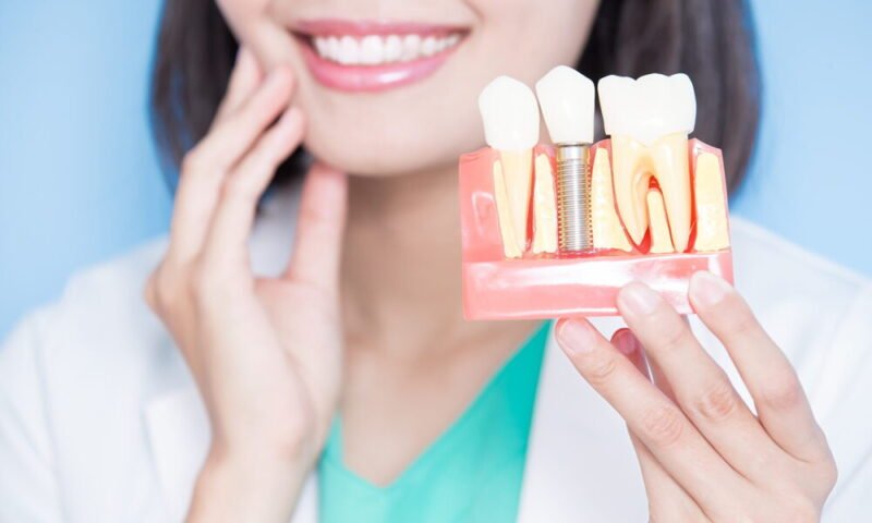comprehensive dental implant services to restore your smile