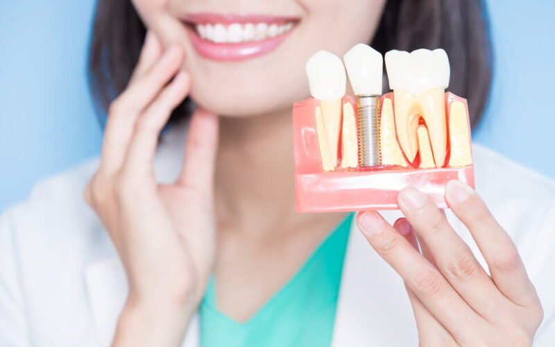 comprehensive dental implant services to restore your smile