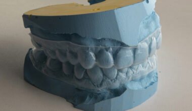 are your teeth in bad shape