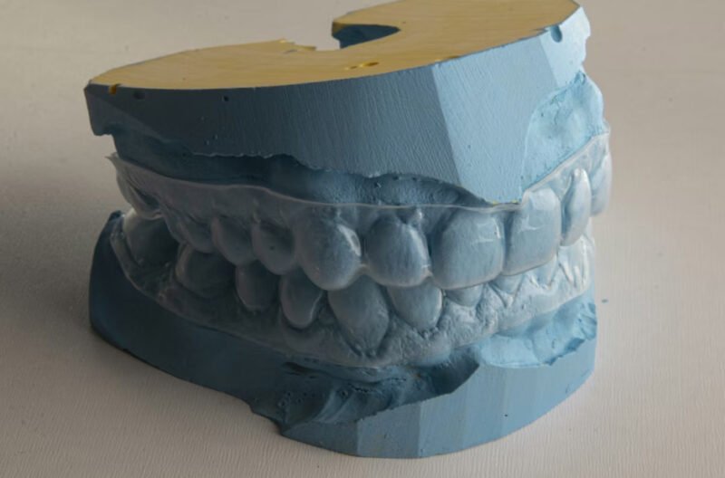 are your teeth in bad shape