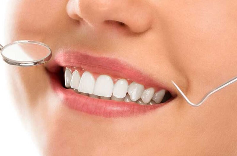 combining multiple treatments for a complete smile transformation