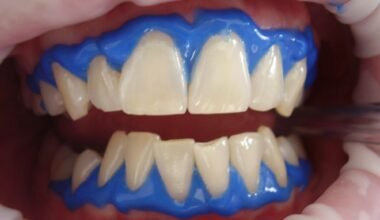 how professional dental care services improve oral health