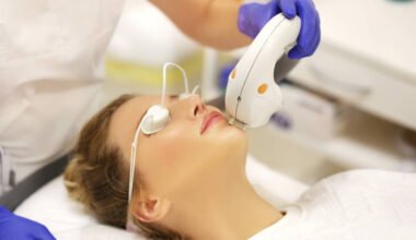 laser options for active breakouts acne