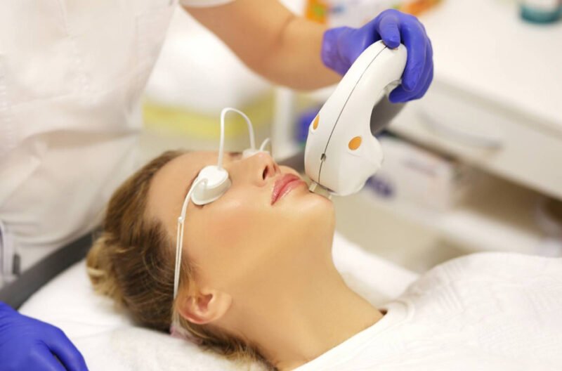 laser options for active breakouts acne