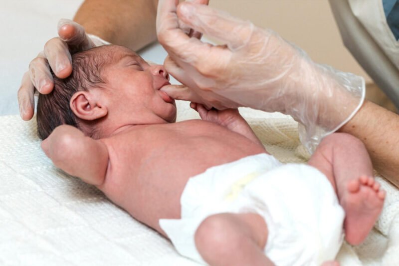 legal options when delayed delivery causes cerebral palsy