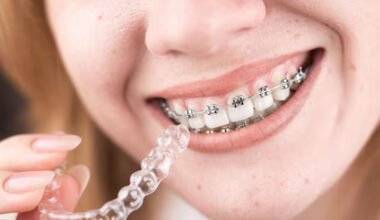 the hidden benefits of clear aligners for adults