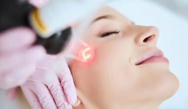 everything you need to know about laser facial treatment
