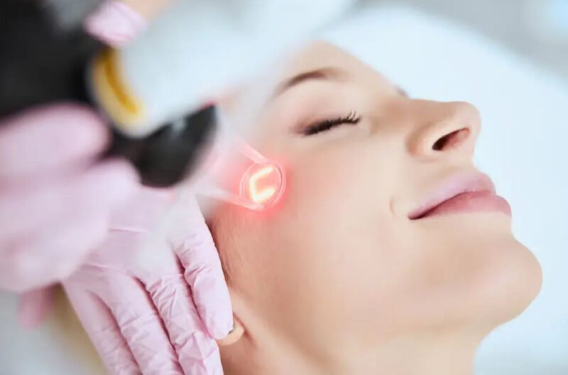 everything you need to know about laser facial treatment