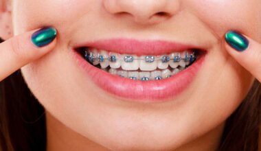 top 4 benefits of dental braces for teens and adults 2