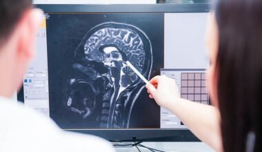 traumatic brain injury claims