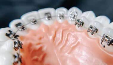 common orthodontic myths parents still believe and what science actually says