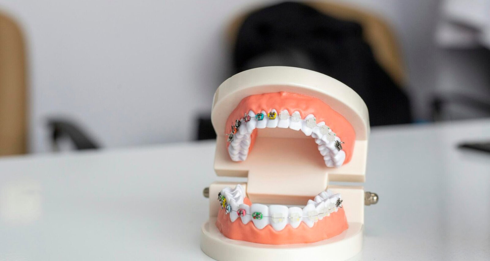 modern alignment care for straighter smiles