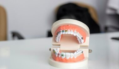 modern alignment care for straighter smiles