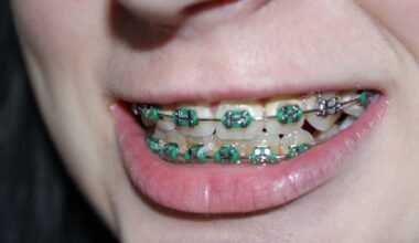 a complete guide to straighter teeth