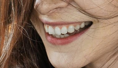 the art of a radiant smile through professional whitening