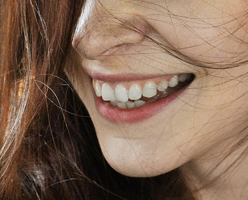 the art of a radiant smile through professional whitening
