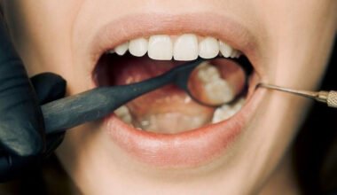 why impacted wisdom teeth lead to serious oral issues