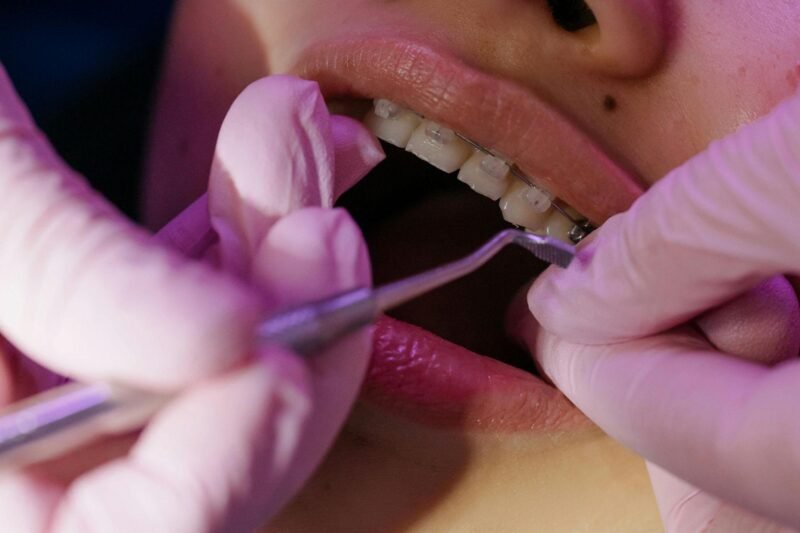 small changes that can make your braces journey way less stressful