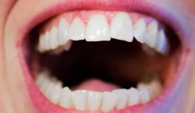 the secret to picture perfect teeth without major procedures