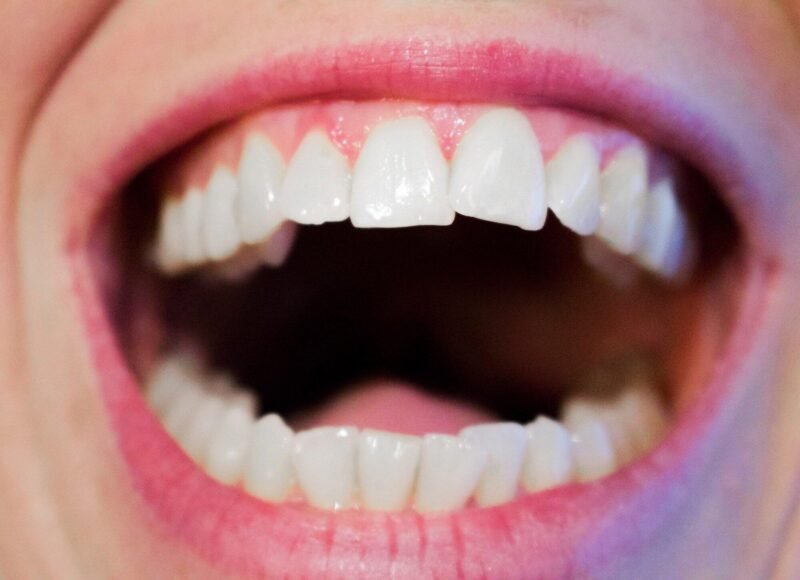 the secret to picture perfect teeth without major procedures