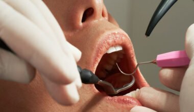 debunking common dental myths