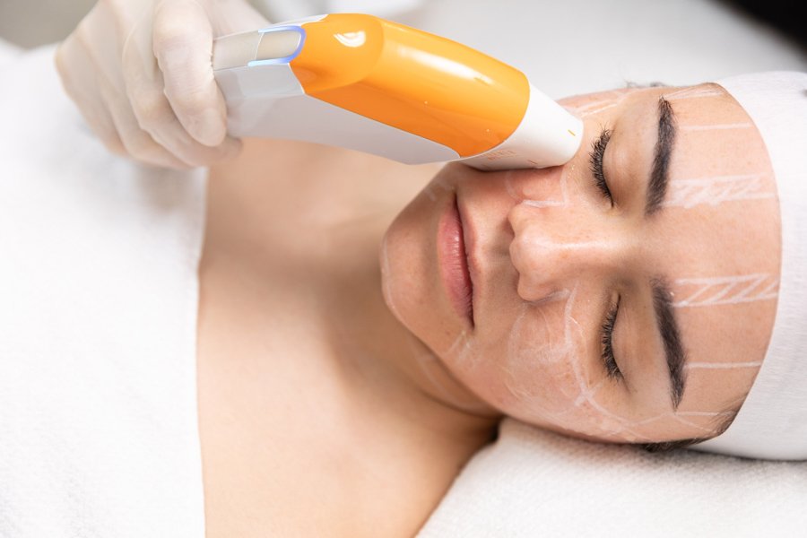 the benefits and innovation of ultraformer mpt in aesthetic treatments