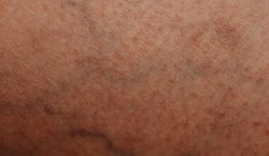 the skin concerns people talk about less—but think about often