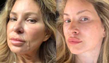 what makes an aesthetic transformation look natural