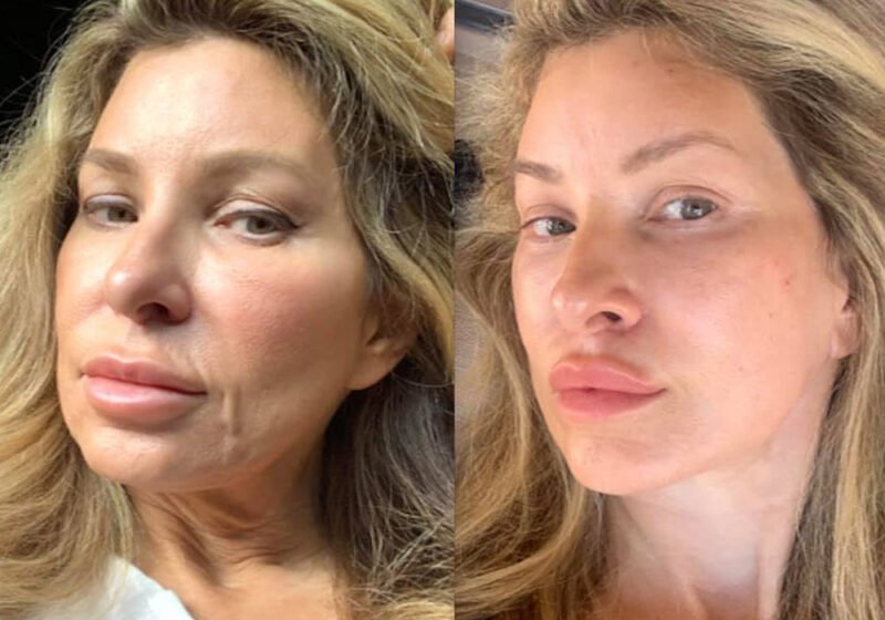 what makes an aesthetic transformation look natural