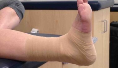 the role of professional athletic tapes in sports recovery