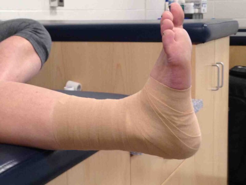 the role of professional athletic tapes in sports recovery